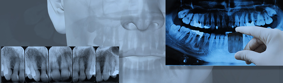 Implantologija